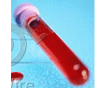 Phlebotomy Colleges & Universities 